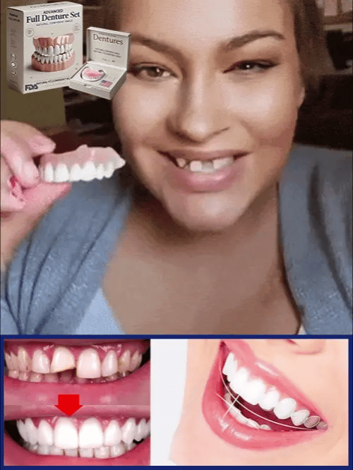 Flexible denture set for upper and lower jaw – reusable & customizable