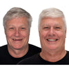 Removable Full-Arch Denture Set with Flexible Cushion Grip for Everyday Use
